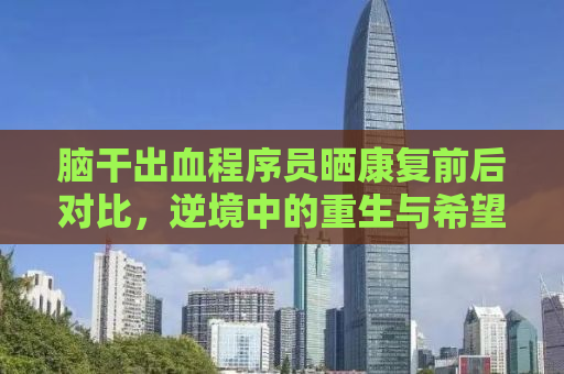 脑干出血程序员晒康复前后对比，逆境中的重生与希望之光